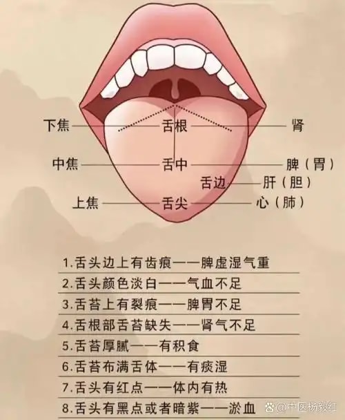 中医舌诊评估