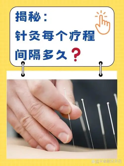 针灸调理疗程