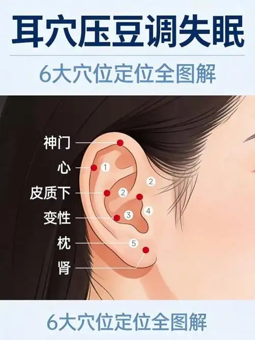 耳穴压豆调理